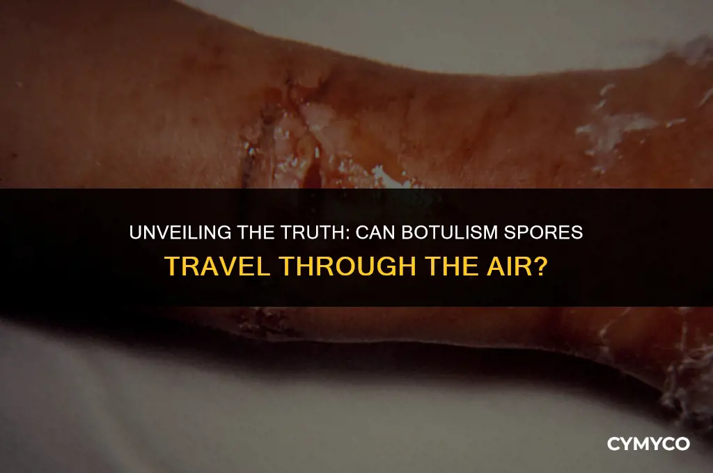 are botulism spores airborne