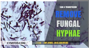 Can Blood Transfusions Eliminate Fungal Hyphae? Exploring the Possibility