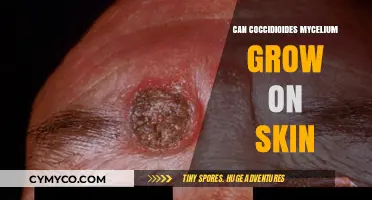 Exploring the Potential of Coccidioides Mycelium Growth on Skin