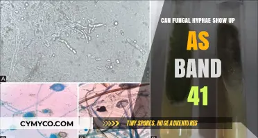Can Fungal Hyphae Appear as Band 41 in Lab Results?