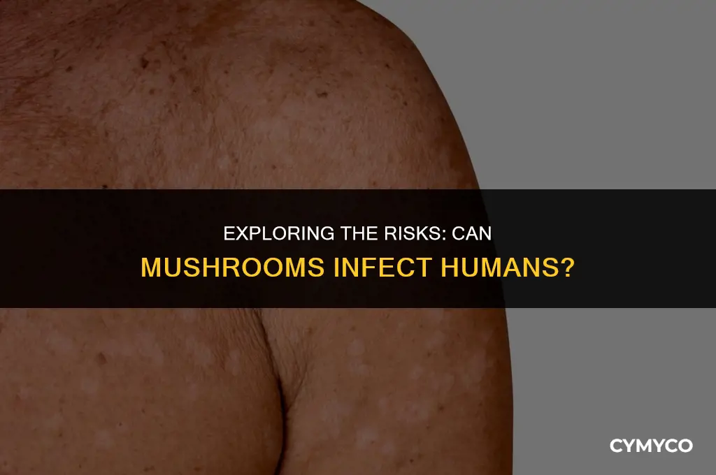 can mushrooms infect humans