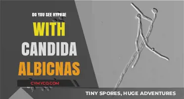 Exploring Candida Albicans: A Closer Look at Hyphae Formation