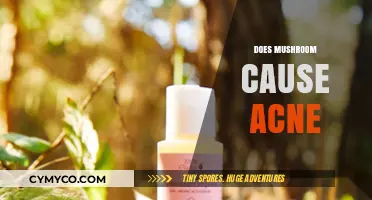 Exploring the Fungal Link: Can Mushrooms Trigger Acne Breakouts?