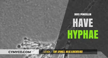 Exploring the Myth: Does Penicillin Really Contain Hyphae?