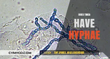 Exploring Tinea: Understanding the Presence of Hyphae in Fungal Infections