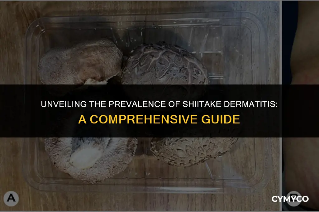 how common is shiitake dermatitis