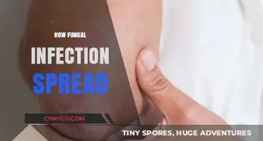 Unveiling the Silent Spread: A Guide to Fungal Infections