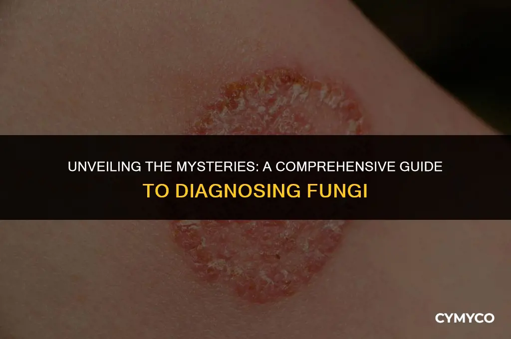 how is fungi diagnosed