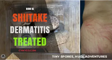 Soothing Shiitake Dermatitis: Effective Treatments and Remedies