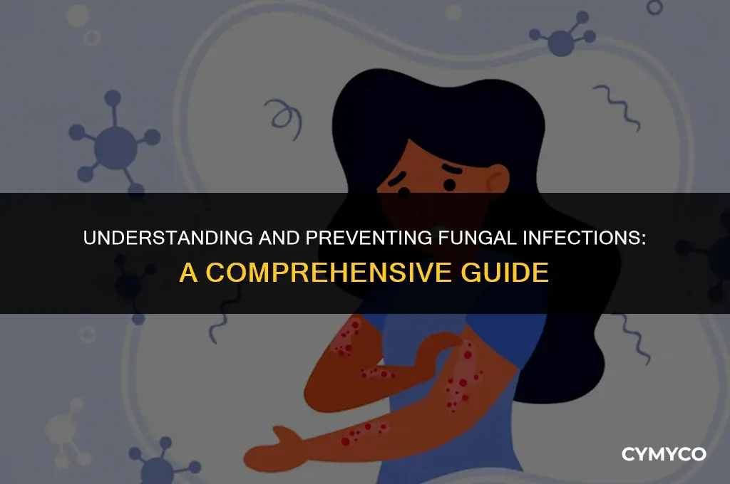 how to get a fungal infection