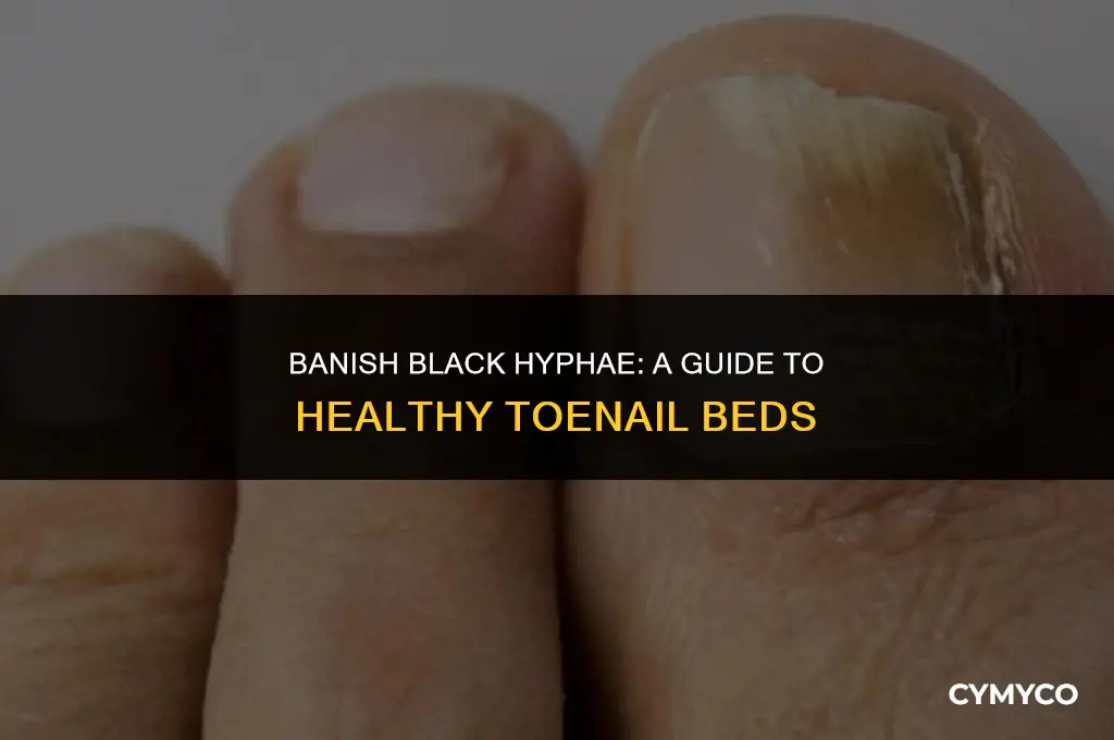 how to remove the black hyphae from toenail bed