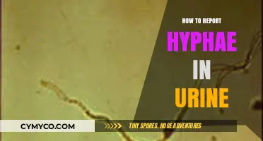 Identifying and Reporting Hyphae in Urine: A Comprehensive Guide