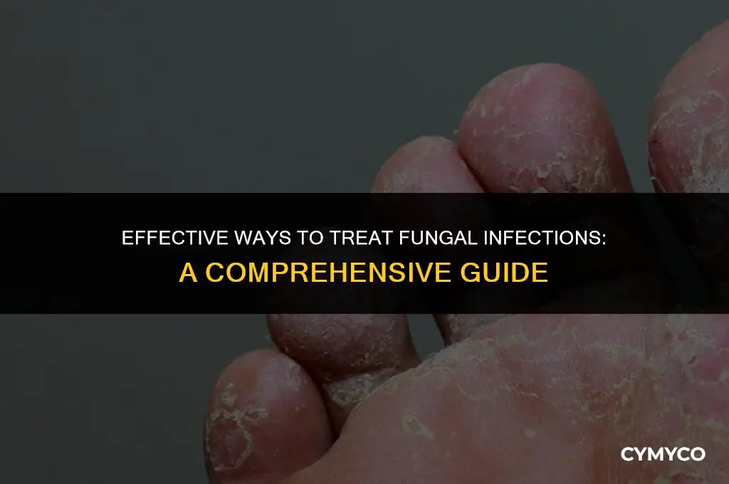 how to treat fungi