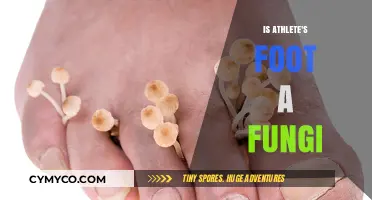 Unveiling the Truth: Athlete's Foot and Its Fungal Connection
