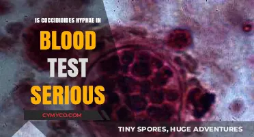 Unveiling the Truth: Coccidioides Hyphae in Blood Tests - A Serious Concern?