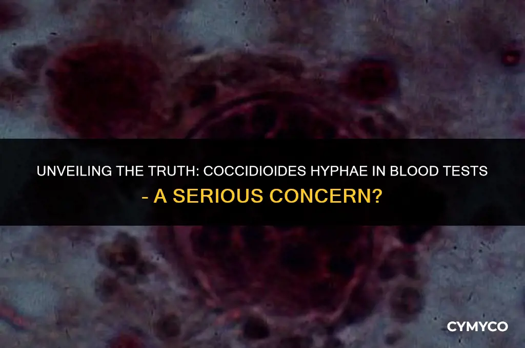 is coccidioides hyphae in blood test serious