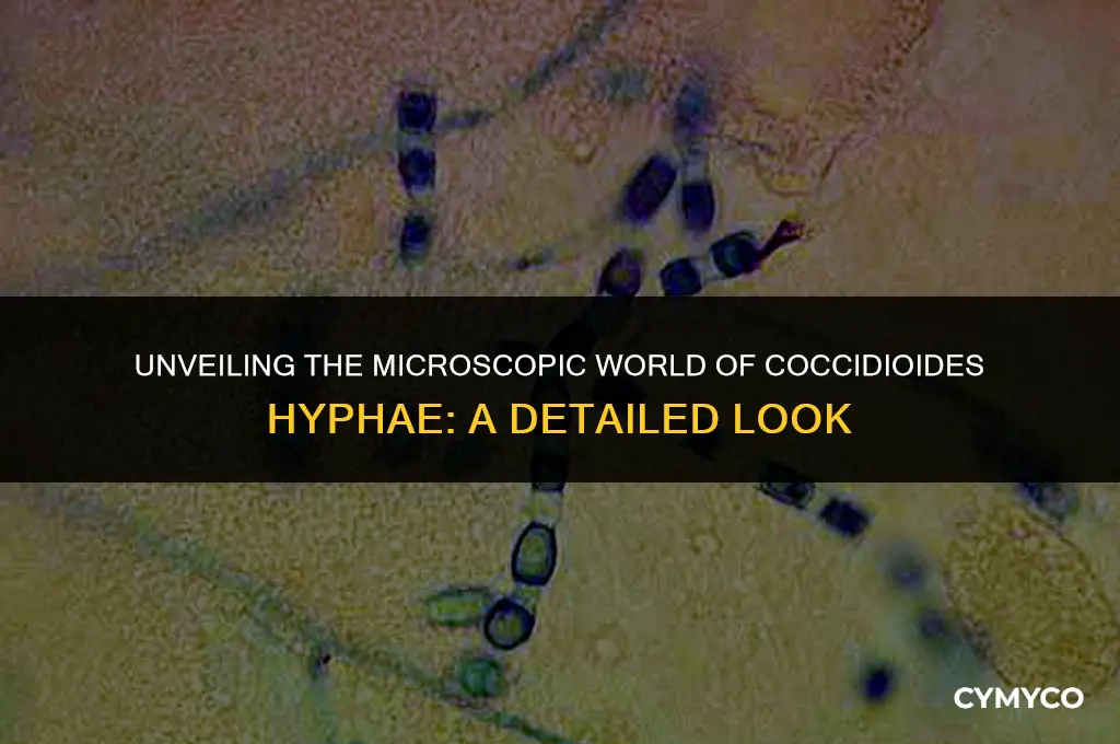 is coccidioides hyphae microscopic