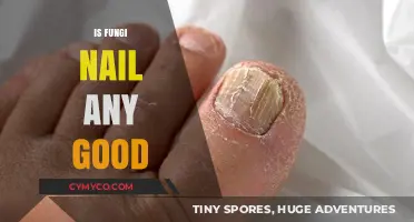 Exploring the Effectiveness of Fungi Nail Treatments: A Comprehensive Guide