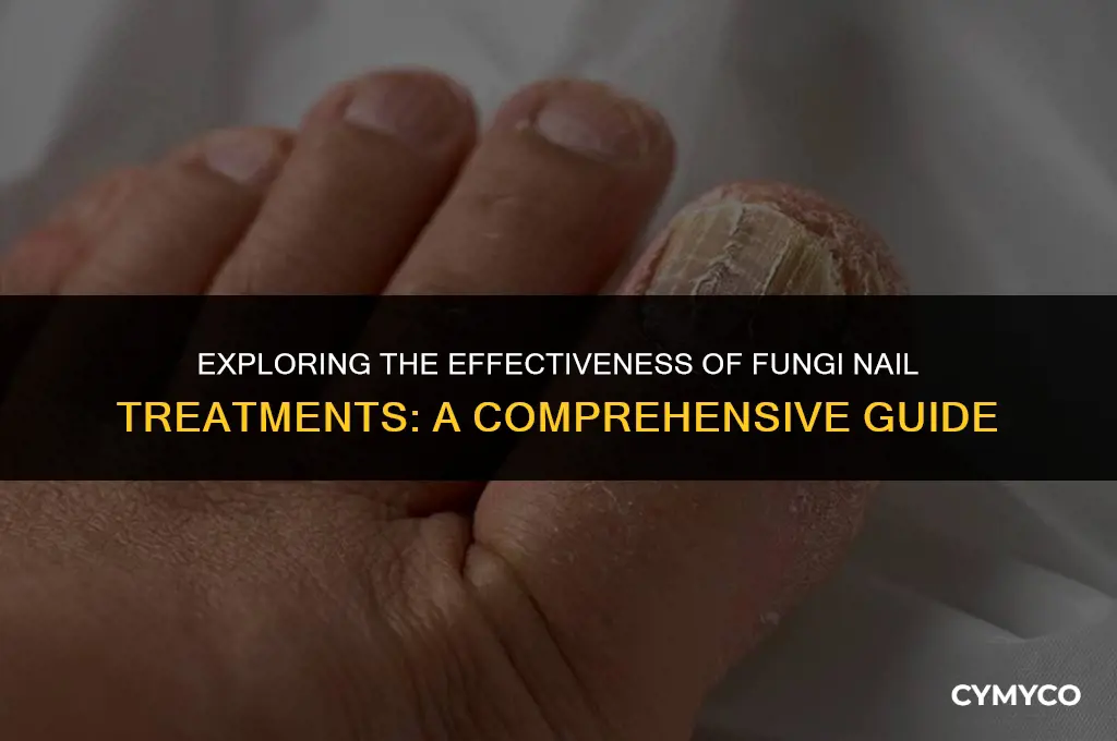 is fungi nail any good