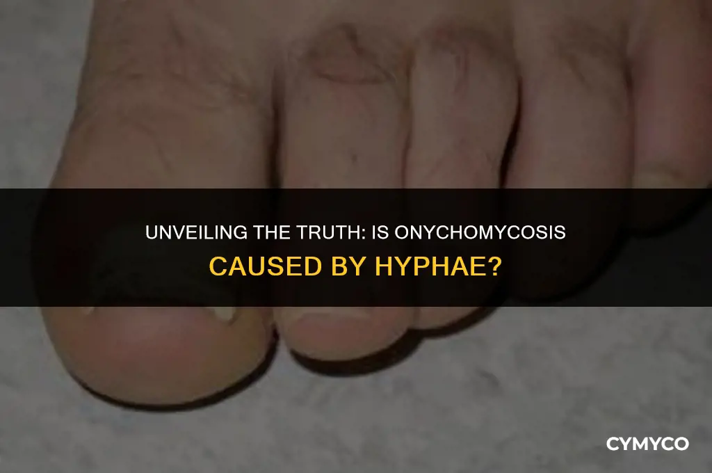 is onychomycosis a hyphae