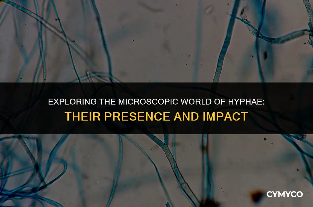 what are hyphae and where are they found