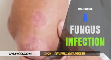 Understanding Fungal Infections: Causes and Prevention Tips