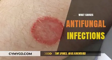 Unveiling the Culprits: What Triggers Antifungal Infections?