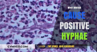 Exploring the Culprits: Diseases Caused by Positive Hyphae
