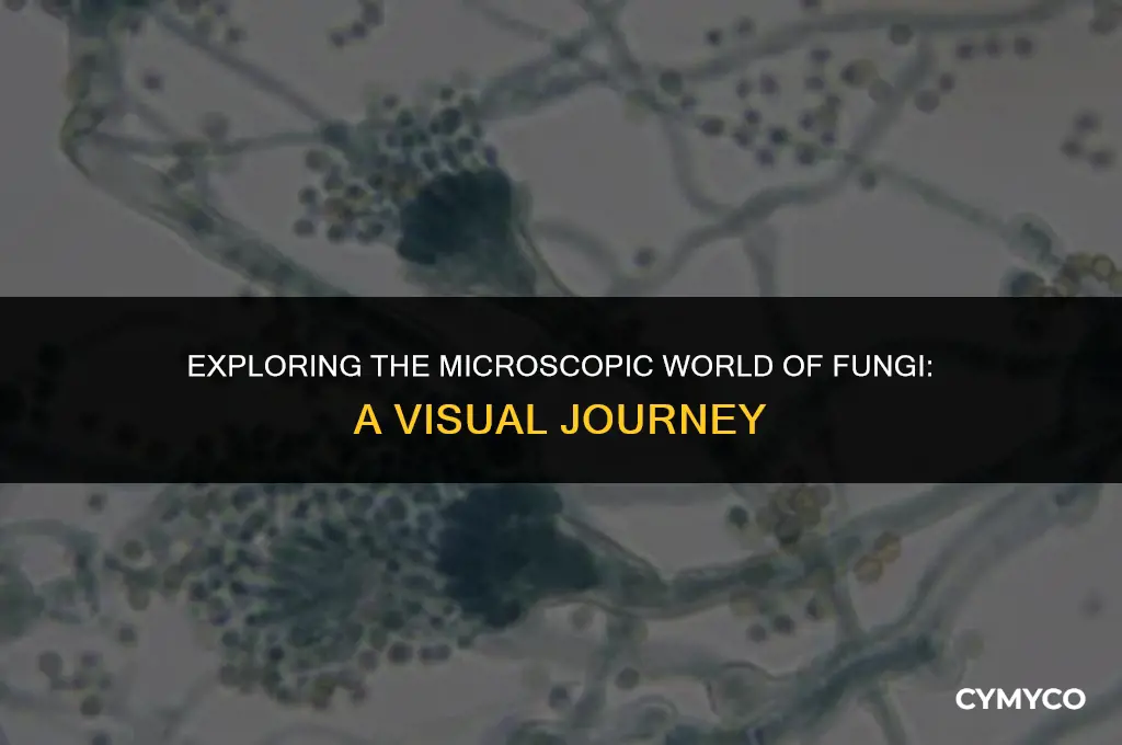 what does fungi look like under a microscope
