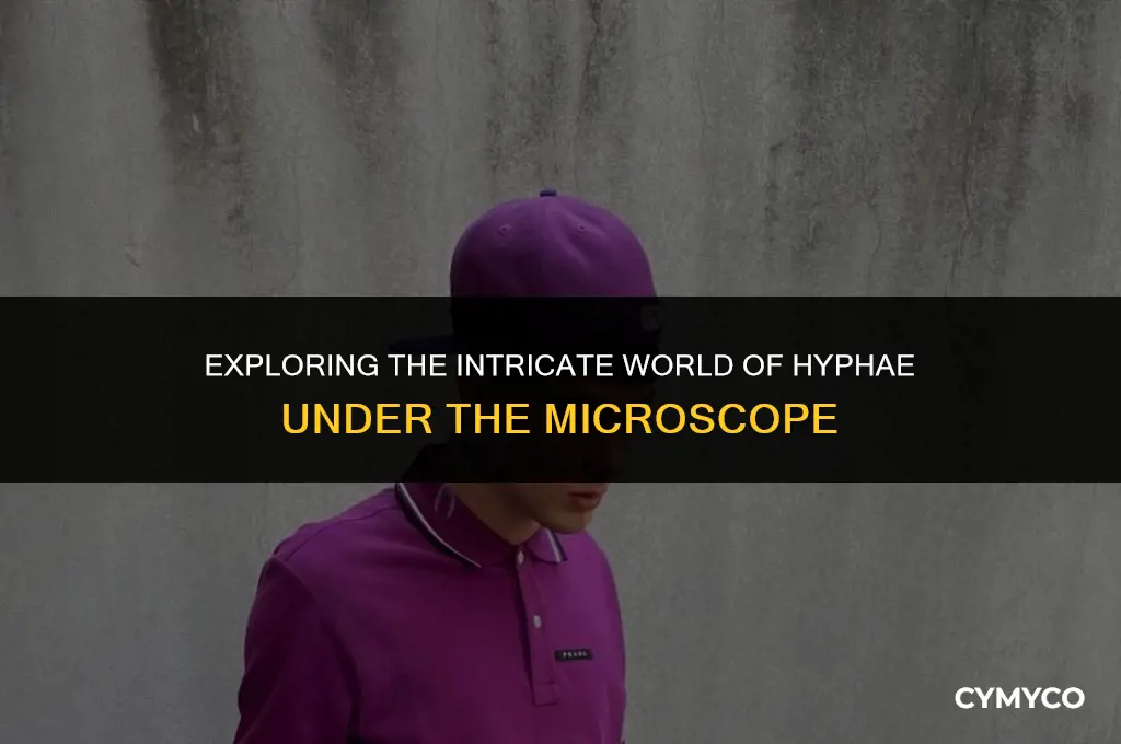 what does hyphae look like under microscope
