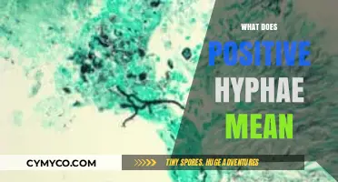 Understanding Positive Hyphae: A Comprehensive Guide to Fungal Growth