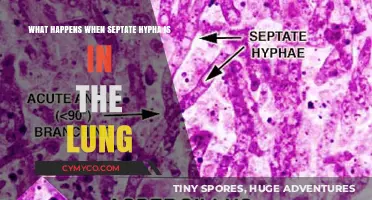 Understanding Septate Hyphae: Implications for Lung Health