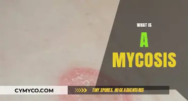 Understanding Mycosis: Causes, Symptoms, and Effective Treatments